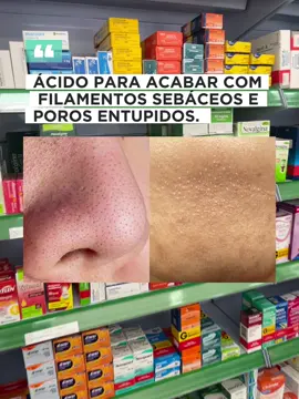 Ácido para acabar com filamentos sebáceos e poros entupidos.  #medicamentos #farmacia #saude #bemestar #rosto #peledorosto #filamentossebaceos #poros #porosentupidos #peleoleosa #cravos #espinhas #acnes #sebo #antiinflamatorio #antimicrobiano #bacteria #skincare #pele #rotinadeskincare 