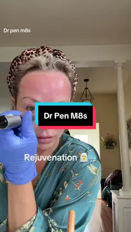 My favorite treatment! #MicroNeedling #AtHomeMicroNeedling #SkinTreatment #FaceTreatment #MicroNeedlingDevice 
