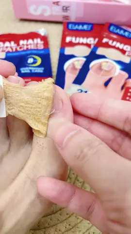 Fix ugly nails while you sleep — these patches saved me 👇#NailTok#FixYourNails#FungalNailSolution#AmazonMustHaves#TikTokMadeMeBuyIt#SkincareButForNails#NailTransformation#beforeafter#SelfCareTools#healthyfood 