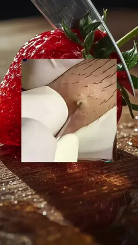 pimple Popping 😔#satisfying #fyp #pimples #cyst #foryoupage❤️❤️ 