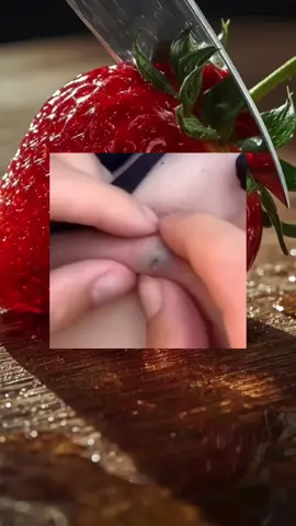 Pimple Popping 😔#pimples #fyp #satisfying #relaxing #viralvideos 