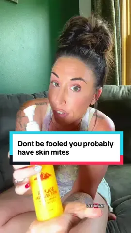 Think your skin’s clean? 👀 Yeah… so did I — until I learned about the mites, bacteria, and buildup we can’t see. This soap? Game changer. 🧼  #TMIbutNeeded #skinmites #mites #tgideas #miteremoval #silversoap #skincleanse #itchyskin #deepclean #bacteriabuster #scabiescare #tiktokmademetryit #skinhygiene #hygiene #bodysoap #tmi #MicroscopicTruth #sulfersoap #itchyskincare #bodysoap #showernecessities #showertok 