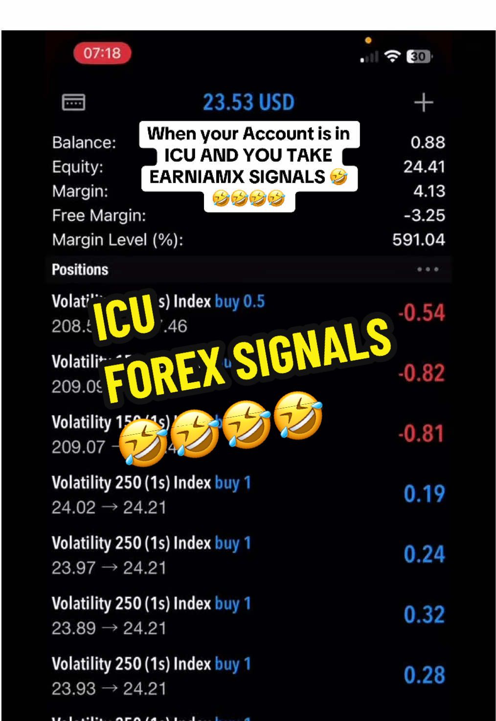 Forex Signals #forexmemes  @Bernie Siala #learntotrade #forex signals #forexmentorshipcommunity #fyp