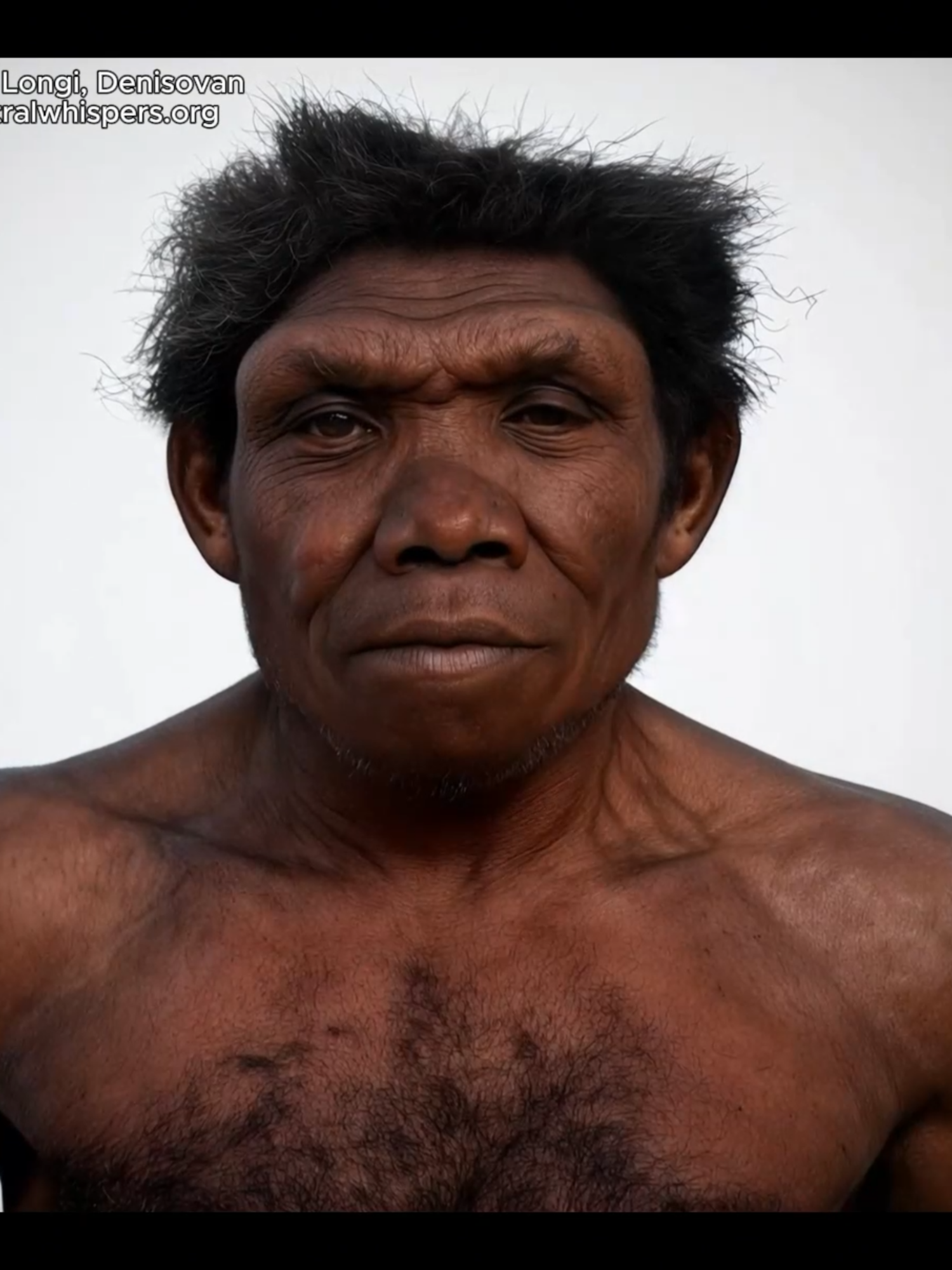 Facial reconstruction of a 146,000-year-old Denisovan from Harbin, China. Homo Longi, also known as the Harbin skull, is a Middle Paleolithic fossil exhibiting a range of archaic features typical of its time. These include a massive skull measuring 221 mm in length and 164 mm in width, a substantial cranial capacity of 1,420 cm³, and a prominent brow ridge that contributes significantly to its overall cranial length. Recently confirmed to belong to the Denisovan lineage, Homo Longi represents a branch of archaic humans that contributed a small but notable portion of DNA to modern East Eurasian populations. #phenotype #ancientdna #genetics #anthropology #skull #denisovan #neanderthal