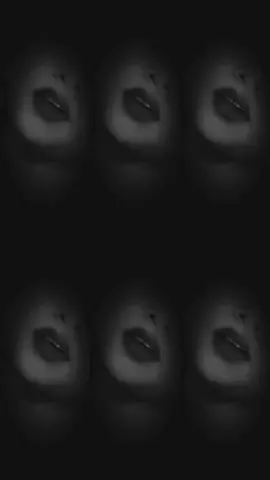 #onthisday #fy #viral #lips #vedio 