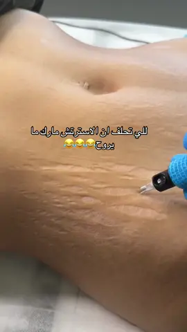 للحجز التواصل الرابط ف البايو❤️