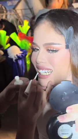 Veneers in just a minute 🦷 