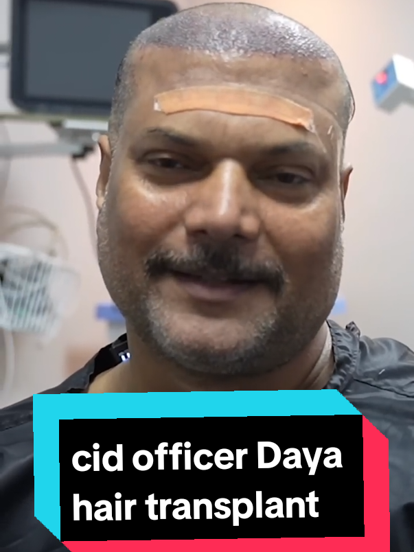 daya hair transplant #cid #daya #indianactor #senior #officer #cid  Best Hair Transplant Clinic in Mumbai, Hyderabad, Uttrakhand, Delhi, Uttar Pradesh, Bangalore, Kolkata, Jaipur etc. For Complete Guidance  (Shorts channel)Hair  First Headwash after Hair  Headwash(how to Rub scalp)After 10 days- First 10 days care After Hair  First 30 days care After Hair  Diet and care for healthy Hair growth- hair, transplant, hair transplant result, Hair transplant tips, hair transplant result month by months, hair transplant before and after as well as hair transplant cost in india. Hair transplant india, fue hair transplant, fue hair transplant result, fue hair transplant results in india, dhi hair transplant result, qht hair transplant result, sahil ayyan  hair transplant result. hair transplant in delhi, hair transplant in Uttarakhand, hair transplant in Uttar Pradesh hair transplant technique as well as best technique #hairtransplant #sahilayyan #hairtreatment #hairregrowth    Copyright Disclaimer Under Section 107 of the Copyright Act 1976, allowance is made for 