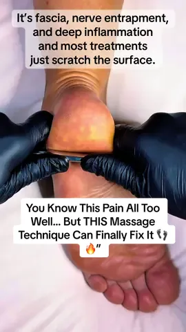 You Know This Pain All Too Well… But THIS Massage Technique Can Finally Fix It 👣🔥” That stabbing, burning, aching heel pain? Yeah… it’s more than just sore feet. It’s fascia, nerve entrapment, and deep inflammation — and most treatments just scratch the surface. But this method? ✅ Breaks up scar tissue ✅ Stimulates blood flow ✅ Targets the root of plantar pain and tension If you’ve tried everything and nothing worked — this might be the relief you’ve been waiting for. Don’t wait until you can’t walk — fix it before it gets worse. 📍Book now via [link in bio] 🧠 Real technique. Real results. 🔁  #HeelPainRelief #PlantarFasciitisFix #FootMassageTherapy #GuaShaHealing #FasciaRelease #ReflexologyWorks #KinesiologyMassage #FootHealthMatters #FixYourFeet #PainFreeSteps #NoMoreHeelPain #DeepTissueRelease #NaturalHealing #KinezioArt #AncientTechniquesModernResults #plantarfasciitis #footpain #footpainrelief 
