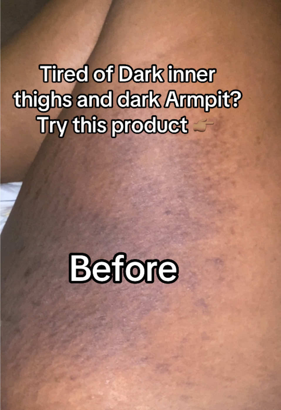 For Recommendations send us Dm or WhatsApp us….. #H#HyperpigmentationTreatmentD#DarkSpotCorrectorC#ClearSkinRoutineS#SkincareTransformationB#BeforeAndAfterSkincareS#SkincareThatWorksN#NigerianSkincareBrandG#GlowWithZinnyL#LuxurySkinCareNGB#BlackSkinCareMattersE#EvenSkinToneN#NaturalComplexionSkincareReview 