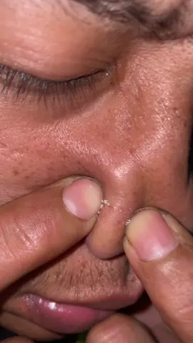Iew bngak begete🤢 #fyp #trending #komedo #stickmask #yesika #cerah 