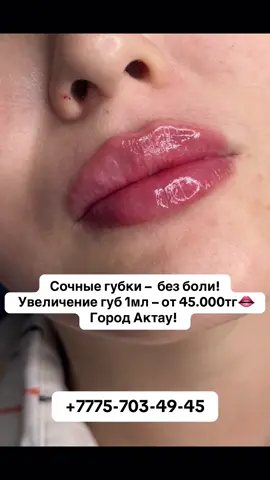 Город Актау! Пишите на ватсап ✅ #актаумангистау #увеличениегуб #актаукосметологоксана #рек #топ 