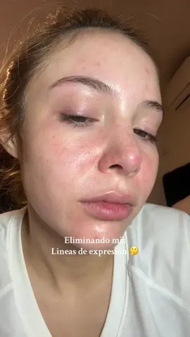 Hay que reponerlo ya🥲  #skincare #skincarecoreano #lineasdeexpresion #surcosnasogenianos #arrugas #arrugasfaciales #retinol #retinal #retinolskincare #retinolcoreano #kbeauty #seoul1988  #seoul1988serum #serumretinol  @KSECRET GLOBAL 