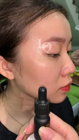 Peel #chamsocdamun#chamsocdaseo#chamsocdanam#tanbinh#govap #Lequynh#Lqspa#hocnghespa  #chamsocda #lequynhspa #lequynhsp#lqspabeautyacdemyahcm#vienthammylqspa #nanmunbangtay #nanmunbangtambong #nanmunbangcay