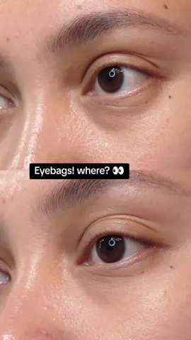 #gifted  ✨ The viral eye cream that actually works 👁👇 Dr. Brandt’s No More Baggage Eye De-Puffing Gel is blowing up for a reason: ✔️ Instantly reduces puffiness & bags ✔️ Brightens dark circles ✔️ Tightens + smooths in 5 minutes ✔️ Layer-friendly under makeup, no pilling Powered by:  ☕ Caffeine to reduce swelling 🧬 Peptides to firm + tighten 🍃 Botanical antioxidants to protect delicate skin If you’ve tried everything for tired under-eyes, this is the one that shows up fast. No concealer. No filter. No needles. 💉 Click the orange 🧡 cart  @Dr. BRANDT Skincare  #NoMoreBaggage #ViralEyeCream #DrBrandtSkincare #DepuffingEyeGel #TikTokMadeMeBuyIt #SkincareThatWorks #UndereyeFix #CaffeineEyeCream #BeforeAndAfter #TikTokShopFinds #BeautyTok #GRWM #dealsforyoudays 