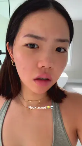 Neck acne?😭💀