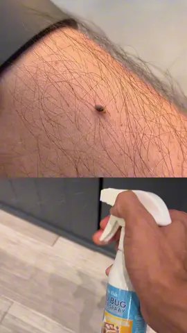 This kind of insect feeds on human blood and can survive half a year without eating. It's called a bedbug. Have you ever been bitten by it?#tiktokshop #bedbugs #bedbug 
