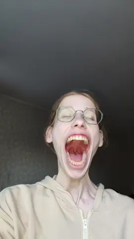 #stitch with @raiaaa78 ummmm😳 get the holy water NOW😳😳😳😆 #teeth #bigmouth #omg #wtf #nooo #viral #stitch I’m not gonna sleep tonight
