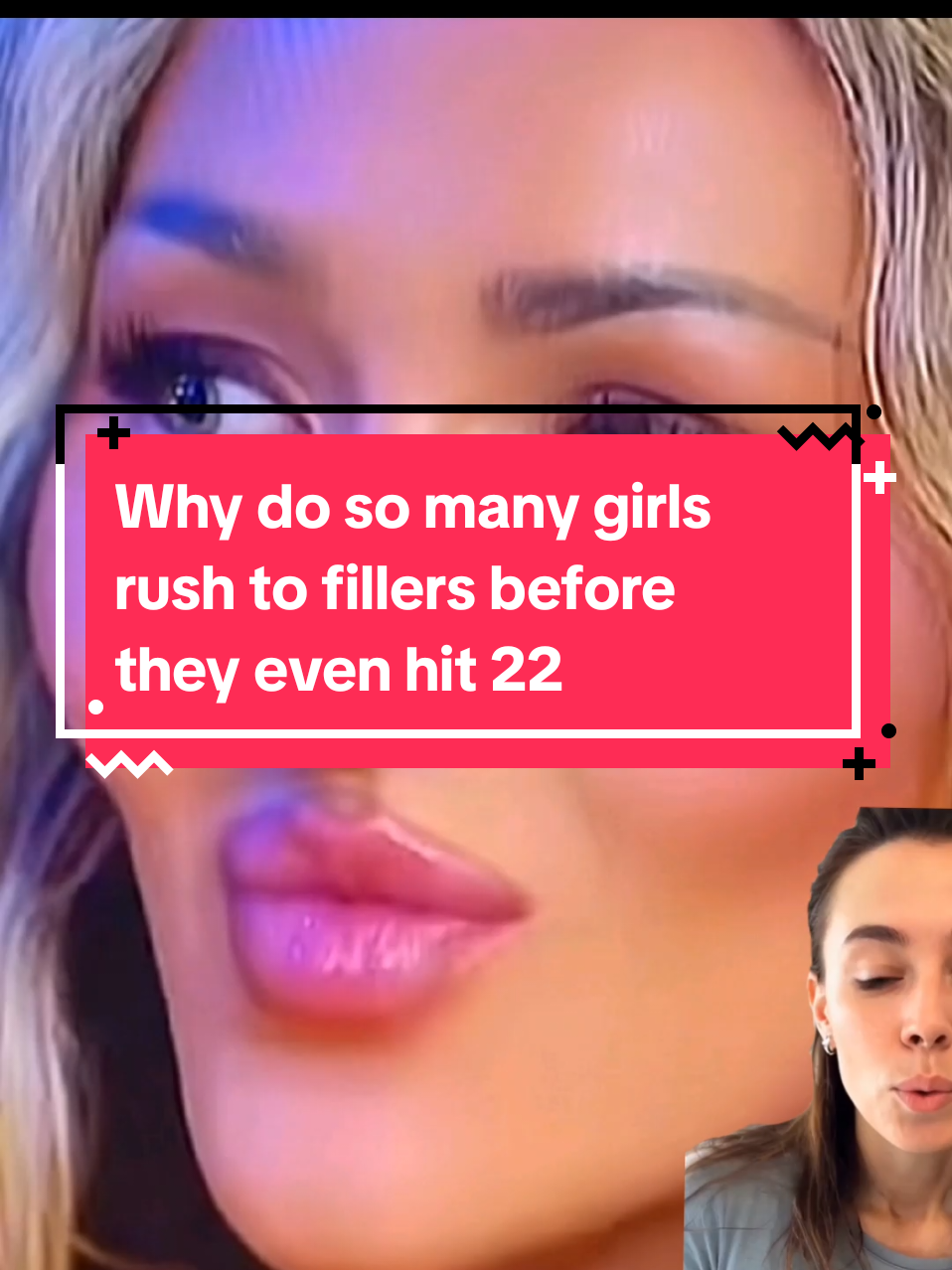 #loveislandusa #vanna #fillers #botox #skincare 