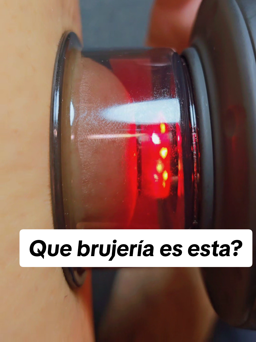 Tienes celulitis? Dolores musculares? este masajeador de ventosa aplica calor terapéutico para relajar tus músculos, activa el drenaje linfático, reduce celulitis y mejora la circulaciòn...que más queremos? 💯🙌 #cuppingtherapy  #cuppingmassage  #cupping #revosmartcupper #DealsforYouDays  #tiktokshopcreatorpicks 