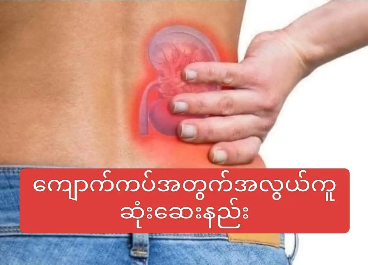 ***အလွယ်ကူဆုံး ကျောက်ကပ်ဆေးနည်း*** အလွယ်ကူဆုံး ကျောက်ကပ်ဆေးနည်းကို မျှဝေပေးလိုက်ပါတယ်။  (၁) ကြက်ရိုးကို ကြာကြာလေး ပြုတ်ပါ။  (၂) ကျောက်ဖရုံသီး တစ်စိတ်ကို ခပ်သေးသေး တုံး၍ ထည့်ပြုတ်ပါ။  (၃) ငရုတ်ကောင်း ၅ စေ့ခန့်ကို ထုထည့်ပါ။ (၄) ဟင်းကျက်ပြီဆိုရင် တရုတ်နံနံပင် အနေတော် ၃ ပင်ခန့်ကို နုတ်နုတ်စင်း၍ ထည့်ပါ။  (၅) ပန်းကန်ထဲထည့်ပြီး သောက်ခါနီး သံပုရာတစ်စိတ်ကို ညစ်ထည့်ပြီး သောက်ပါ။ အရည်ရော အဖတ်ပါ စားပါ။ တစ်အိုးလုံး မကုန်မချင်း နားနားပြီး စားပါ။ (၆) အနည်းဆုံး တစ်လတစ်ကြိမ်လောက် ကျောက်ဖရုံသီးဟင်းချိုကို ချက်သောက်ပါ။  ကျောက်ကပ်ဟာ လူသားတွေအတွက် အရေးပါဆုံးအလုပ်တွေကို လုပ်ဆောင်ပေးနေတဲ့ အရေးကြီးတဲ့အရာတစ်ခု ဖြစ်ပါတယ်။ နေ့စဉ် စားသောက်နေတဲ့ အစားအစာများကို စစ်ထုတ်ပေးရတယ်။  ယနေ့ခေတ် အစားအသောက်များကလည်း ဟိုအရင်လို သဘာ၀အလျှောက် တောထဲကရတဲ့ အသီးအနှံ၊ ဟင်းသီးဟင်းရွက်က ရှားပါးသွားပြီး နည်းပညာအမျိုးမျိုးနဲ့ ထုတ်လုပ်တာကိုပဲ စားသုံးနေရပါတယ်။ အဆိပ်အတောက်မျိုးစုံလည်း ပါ၀င်နေပါတယ်။ ကြာလာတော့ ကျောက်ကပ်ကို သွားထိပါတယ်။ ကျောက်ကပ်က မစစ်ထုတ်နိုင်တော့ အခဲဖြစ်ကျန်ရစ်ပြီး ကျောက်ကပ်မှာ ကျောက်တည်ရောဂါများ ဖြစ်လာကြပြီး ဆေးရုံတက်ခွဲနေကြသူတွေ မနည်းပါဘူး။ အစာလည်းဆေး၊ ဆေးလည်းအစာ ဆိုတဲ့စကားအတိုင်း ကျောက်ကပ်အတွက် အကောင်းဆုံးဟင်းတစ်ခွက်ကို ညွန်ပေးလိုက်ရပါတယ်။  ကျန်းမာပျော်ရွှင်ကြပါစေ🙏🙏🙏 ပြန်လည်မျှဝေပေးခြင်းဖြစ်ပါသည် အခြားသူများလည်းသိစေရန်ပြန်လည်မျှဝေခြင်းဖြင့်ကျန်းမာရေး ကုသိုလ်ယူပေးကြပါရန် မေတ္တာရပ်ခံအပ်ပါသည်။ #လေးစားစွာဖြင့်မူရင်းရေးသားသူကို  #Creditပေးပါသည် 🙏🙏🙏 #ကျန်းမာရေးဗဟုသုတများ  #PyaeSoneAung  #ကျန်းမာရေး  စောနွဲ့နေဆိုင် (ပူတာအို)