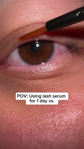 Try the viral lash serum with me 💖