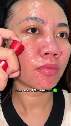 Nyesel baru paham rumus pake retinal trnyata bisa bikin kulit seglowing ini😍🫰🏻  #retinal #jerawat #elsheskin #glowing #retinalserum 