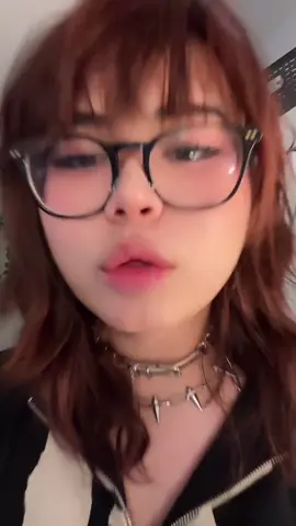 Kissesssssesss##