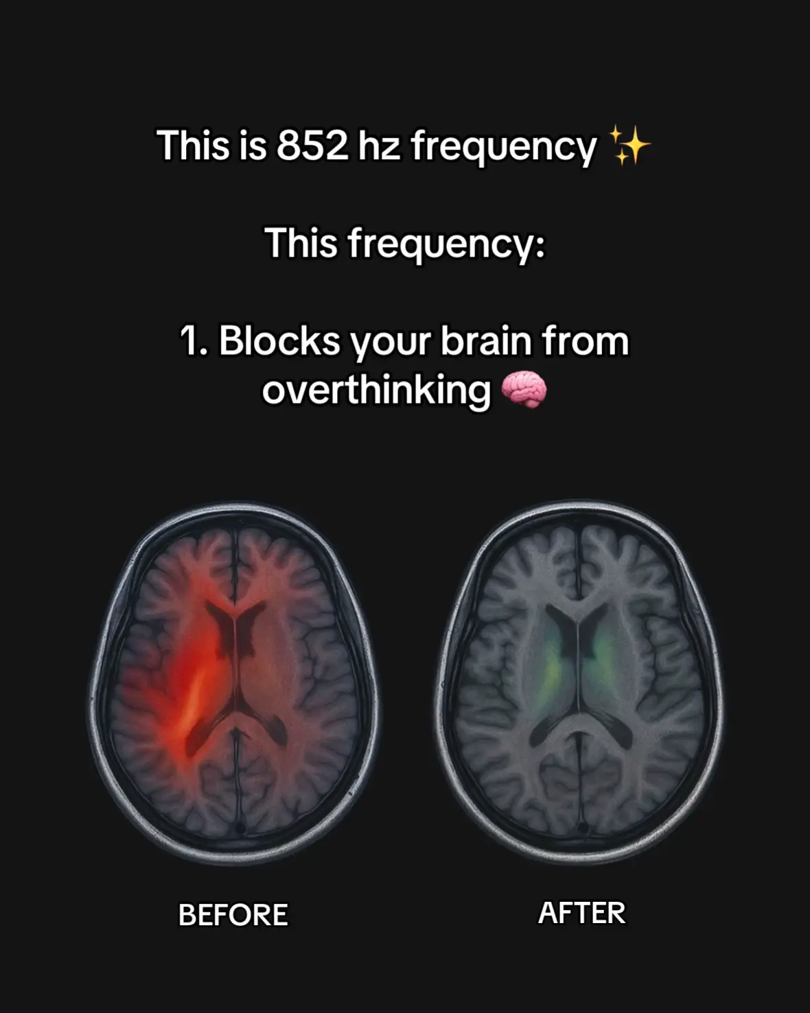 852 hz solfeggio frequency to reduce stress and overthinking 🌞 #solfeggiofrequencies #852hz #HealingJourney #spiritualtiktok #healingtiktok #frequency 