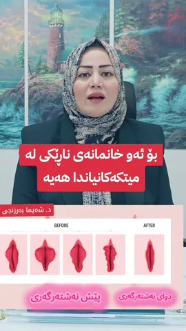 #drshaymanawzad 