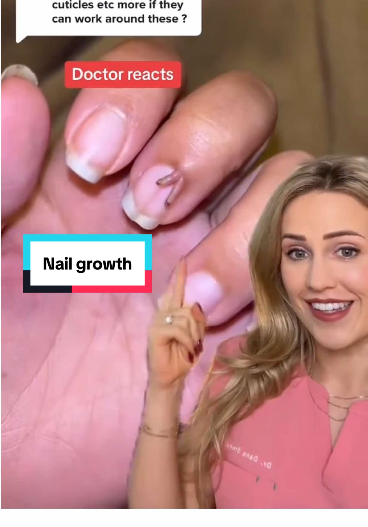 Acquired digital fibrokeratoma is also known as acral fibrokeratoma. Although benign, it can look very similar to some skin cancers, so always see a doctor! 🎥 @jalenuhhhh #keratoma #skinhealth #doctor #medical