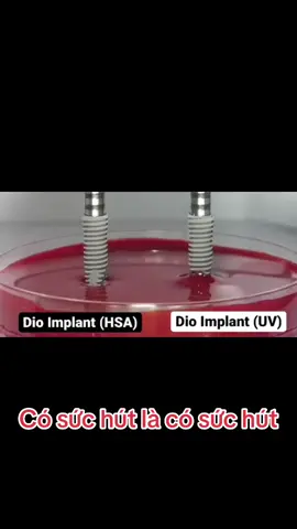 Tự nhưng lời bài rap vang vang trong đầu “Tụi m chỉ biết hút không chịu đi khám phá”🤣🤣 #implant @ImplantDio #diouv #implantdigital #xuhuongtiktok #xuhuongtiktok #bsnguyenngochung #nhakhoaparisconghoa #nhakhoaparis 