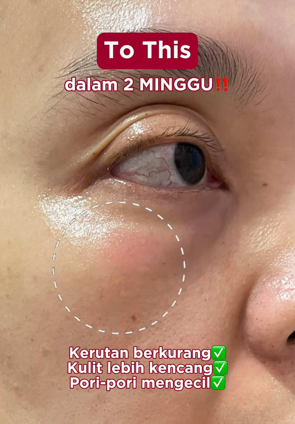 Masih pake konsentrasi Retinol yang nanggung? Move on ke 1% Pure Retinol NightCharge Booster yang efektif, tanpa bikin kering❤️ #ERHAAgeCorrector #HydratingPureRetinol 