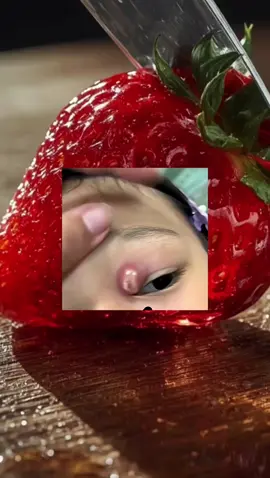 Her eyes says it all🥲💔#relaxing #Satisfying #pimples #viralvideos#Emotional 