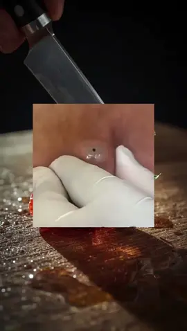 if you see this send him a prayer 🙏🤲#Emotional #viralvideos #pimples #Satisfying #relaxing #Sad 