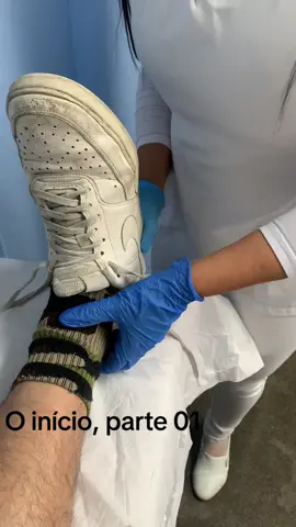 Gesso,pé #gesso #yeso #caster #asmr #asmrtiktoks #asmrrelajante #asmrvideo #asmrviral #videoviral #video #brasil #saopaulo #riodejaneiro #us #estadosunidos🇺🇸 #japan #italy #italia #africa #african #mocambiquetiktok🇲🇿 #angola🇦🇴 #portugal #bolivia🇧🇴 #foryoupage #fouryou 