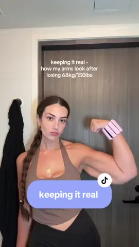 a realistic look at what my arms look like after losing 68kg/150lbs 💪🏼 this audio 😮‍💨  #gastricbypass #gastricbypassjourney #weightlosstransformation #bariatricsurgery #looseskin 