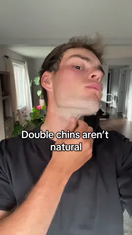 Probably the easiest thing you can do to get more attractive #jawline #GlowUp #transformation 