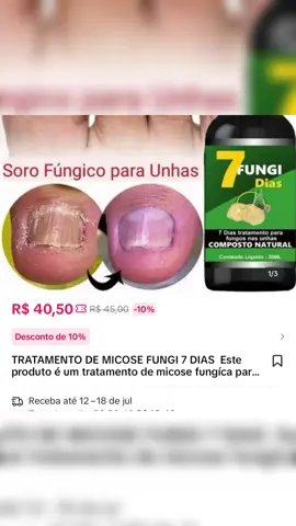 TRATAMENTO DE MICOSE FUNGI 7 D #tratamentodeunha #chegounasuacasa #tiktokshop #foyoupage #fyp 