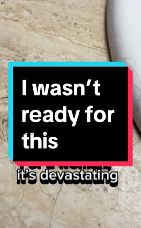 I wasn’t ready to lose my hair. But I’m not giving up on it either. 💔 #realtalk #kindpatch #hairthinning #menopausehairloss #wellnesstiktok #over40beauty