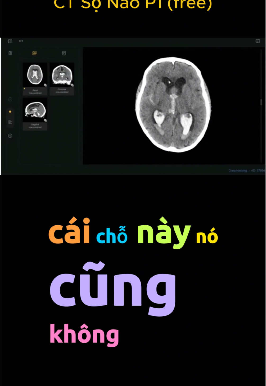 Lớp CT sọ não còn vài slot cuối thui nè #faquiz #hocycogivui👩🏻‍⚕️💙 #sinhvienyduoc #trending #faclass #giaiphau #ctsonao 