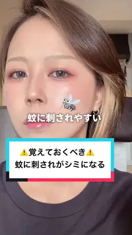 30越えると一気に蚊に刺されがシミになります😇ﾂﾗｯ #シミ #蚊 #🦟 #スキンケア 
