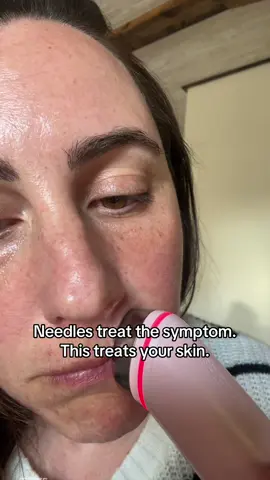 Boosts product absorption, barrier health, glow… all without injections. 🧖‍♀️🌀 #skincaretok #medicubeSuperSale #glassskinroutine #medicubedealsforyoudays #dealsforyoudays #medicubeSuperSale #tiktokshopcreatorpicks 