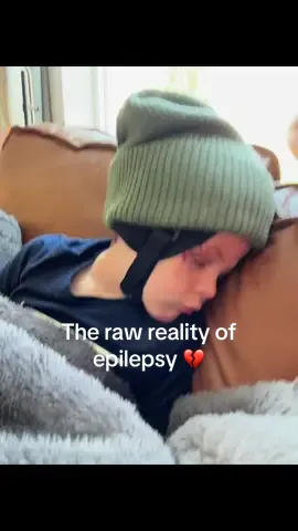 Very vulnerable, raw post. #epilepsy #childhoodepilepsy #seizure