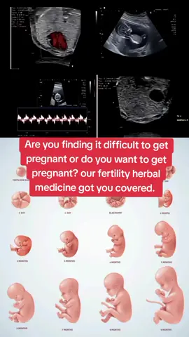 DM to order Fertility medicine to conceive and give birth to healthy babies. Are you finding it difficult to get pregnant or do you want to get pregnant? our fertility herbal medicine got you covered.  #ttccommunity  #ttcjourney  #infertiltiy  #pregnancy #infertilityjourney  #antinatal  #pcosproblems  #barreness  #menopause  #fertilitystore  #miscarriageawareness  #postnatal  #fyp  #viral  #tiktokviral  #tiktoknigeria  #tiktokusa  #tiktokfrance  #pcos  #infertilitytreatment  #testtubebaby  #ivfclinicdelhi  #fertility  #infertility #ttc #ivf  #baby  #pregnancy  #health #child  #fertility  #viral #shivamivfcentredelhi  #shivamivfclinic  #fyp  #iui   #ivfcommunity  #infertilitvawarenesccomodation  #canada  #trend  #shivamivf  #fibroids  #conceive  #tryingtoconceive  #short  #time  #canada_life  #ourfamilyourjourney  #trancetiktok #italy #uklife #usa  #kuwait  #kuwait  #england  #america  #london  #ireland  #florida  #california  #mexico  #texas #pregnantstyle  #pregnantyoga  #pregnancydiet #pregnancydiary  #Love  #life  #pregnancyfashion  #parentingtips  #momlife  #dadlife 