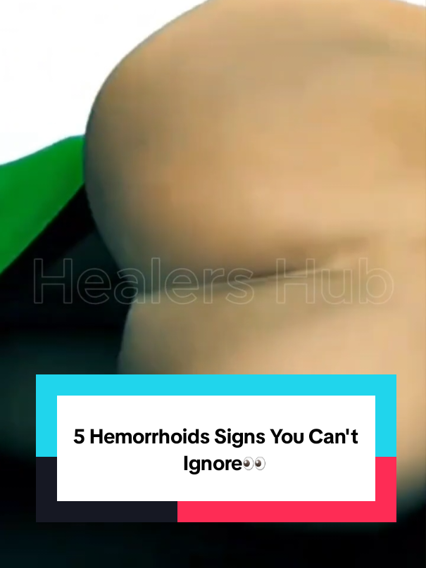 5 Warning Signs of Hemorrhoids You Shouldn’t Ignore 🚽😳 | #healthtips #hemorrhoids #piles #guthealth #wellnesstips #tmi #digestivehealth #pooptalk #fyp
