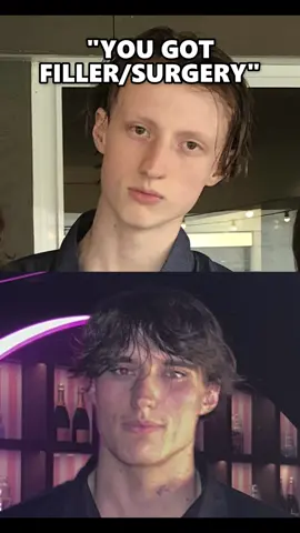 the surgery accusations never end