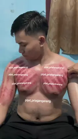 #masukangin #kerok #kerokan #pijat #pijit #massage 
