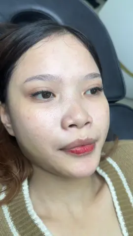 MÔI THIẾT KẾ - Phiên bản này đã được nâng cấp 🫦🫦 #Truongkhangnhi #Fillerbotoxdephcm #Moithietke #tiemmoi #lamdep #Trending #Viral #xuhuongtiktok 