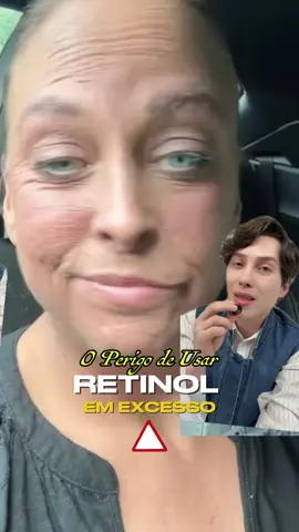 O perigo de exagerar no uso do retinol. Venha entender sobre como usar retinol e como não usar retinol no skincare.  #retinol #acidoretinoico #peleirritada #skincare #skinarmy #cuidadoscomapele  @JARDEL | SKINARMY 👊🏻 